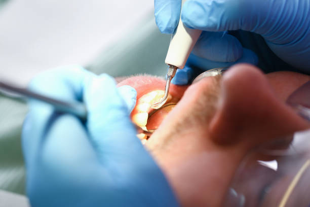 Best Pediatric Emergency Dentist in Mont Belvieu, TX