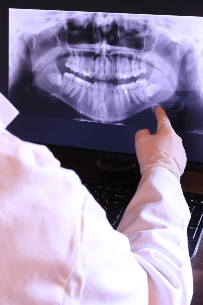Best Emergency Dental Care for Abscessed Tooth in Mont Belvieu, TX