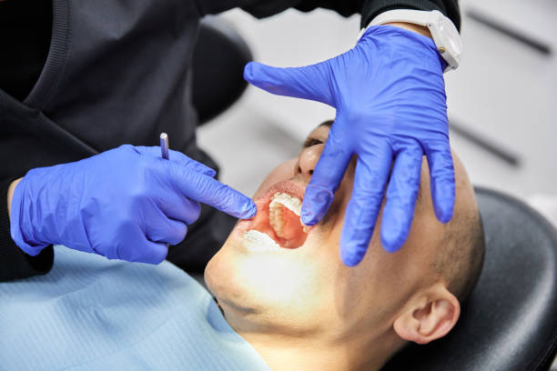 Best Emergency Dental Extractions in Mont Belvieu, TX
