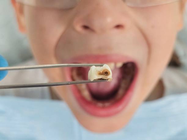 Best Weekend Emergency Dentist in Mont Belvieu, TX